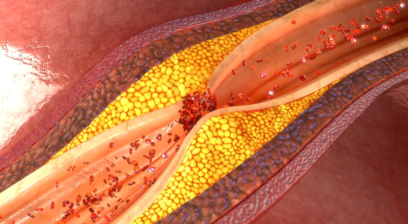 Protocolo Extrato Natural